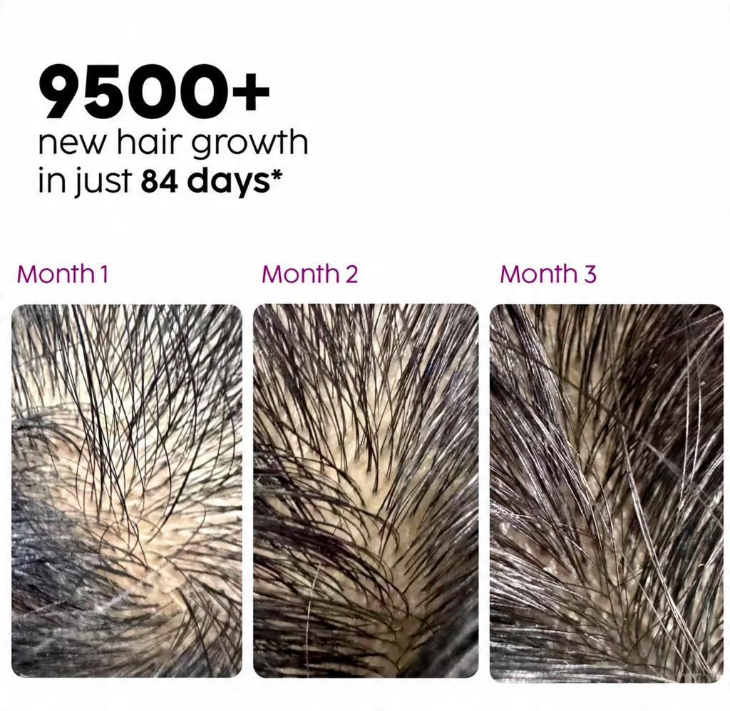 Extreme Hair Growth Serum 100 ML